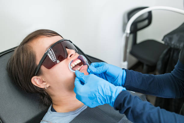Best Knocked-Out Tooth (Avulsed Tooth) Treatment in Catonsville, MD